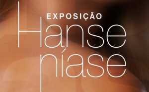 Exposição no RibeirãoShopping alerta para a conscientização da hanseníase