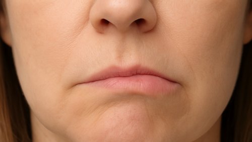 Síndrome de Bell: conheça a doença que paralisa metade do rosto