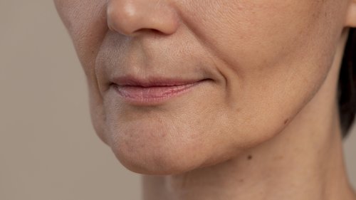 Derretimento facial: Como a perda rápida de peso afeta a aparência do rosto