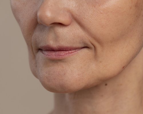 Derretimento facial: Como a perda rápida de peso afeta a aparência do rosto