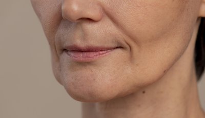 Derretimento facial: Como a perda rápida de peso afeta a aparência do rosto
