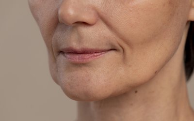 Derretimento facial: Como a perda rápida de peso afeta a aparência do rosto