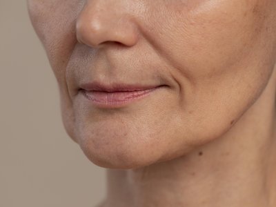 Derretimento facial: Como a perda rápida de peso afeta a aparência do rosto