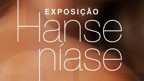 Exposição no RibeirãoShopping alerta para a conscientização da hanseníase